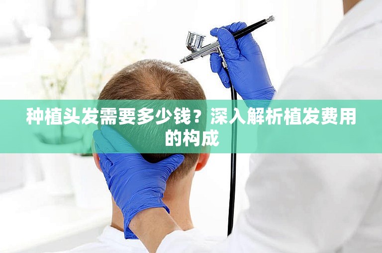 种植头发需要多少钱?深入解析植发费用的构成 种植头发需要多少钱?深入解析植发费用的构成