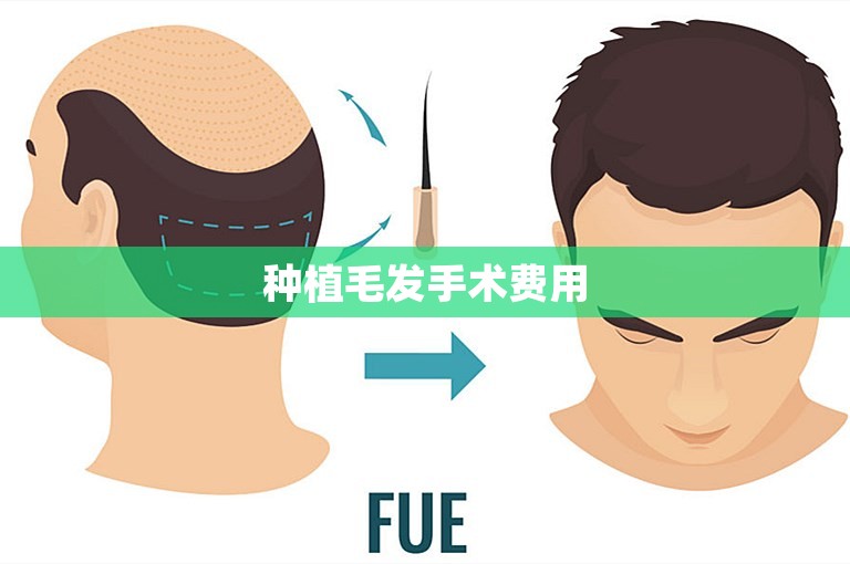 种植毛发手术费用