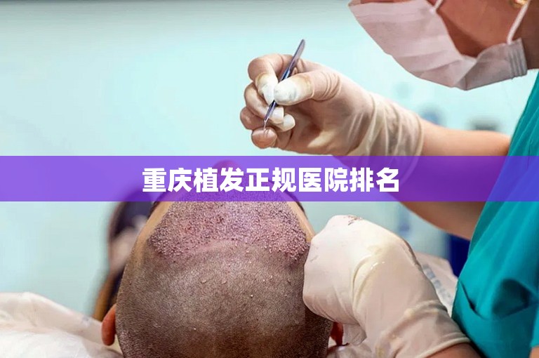 重庆植发正规医院排名