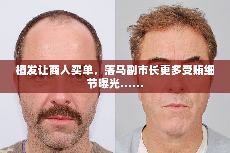 植发让商人买单，落马副市长更多受贿细节曝光……