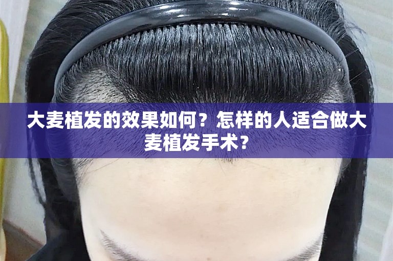 大麦植发的效果如何？怎样的人适合做大麦植发手术？