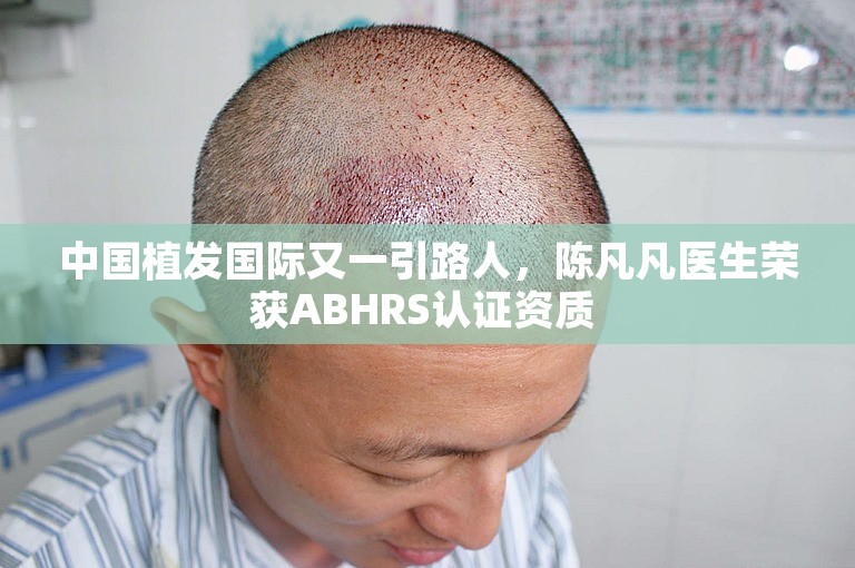 中国植发国际又一引路人，陈凡凡医生荣获ABHRS认证资质 