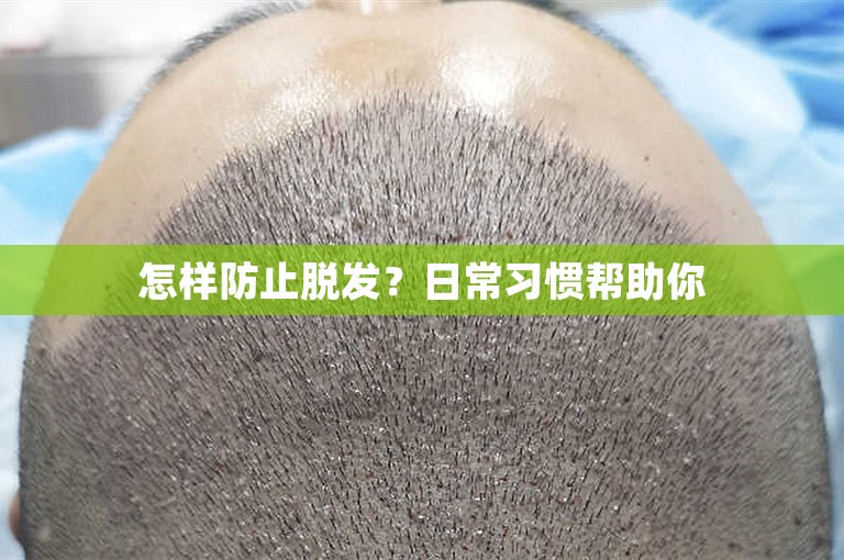 怎样防止脱发？日常习惯帮助你