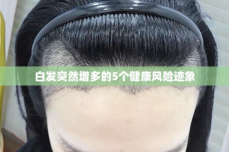 白发突然增多的5个健康风险迹象 白发突然增多的5个健康风险迹象