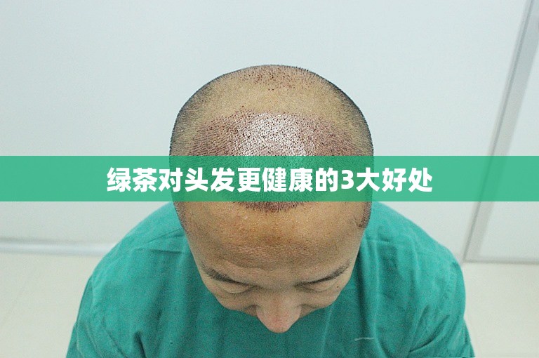 绿茶对头发更健康的3大好处