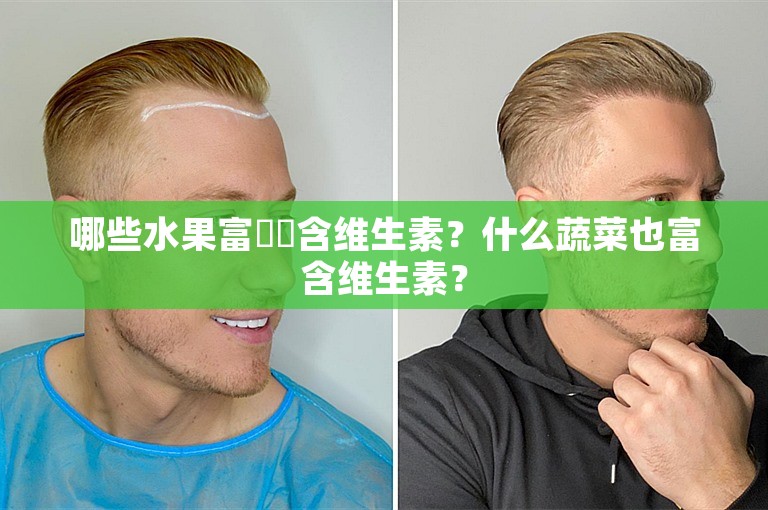 哪些水果富​​含维生素？什么蔬菜也富含维生素？