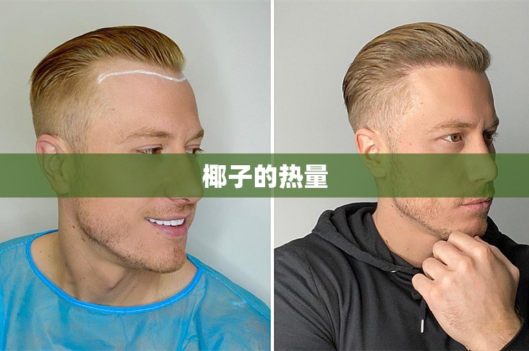 椰子的热量 椰子的热量