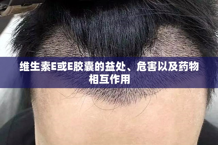 维生素E或E胶囊的益处、危害以及药物相互作用