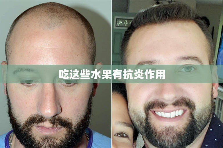吃这些水果有抗炎作用