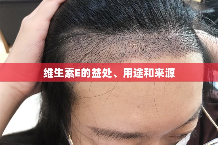维生素E的益处、用途和来源