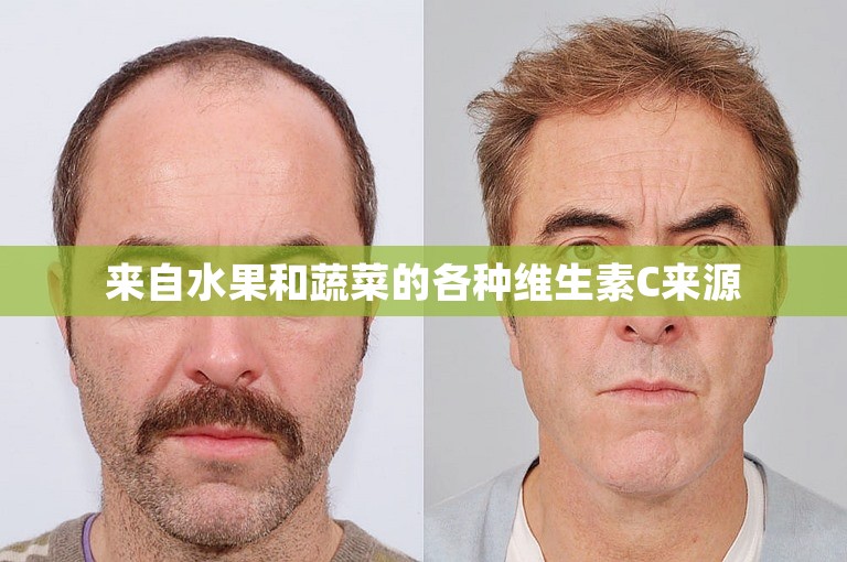 来自水果和蔬菜的各种维生素C来源