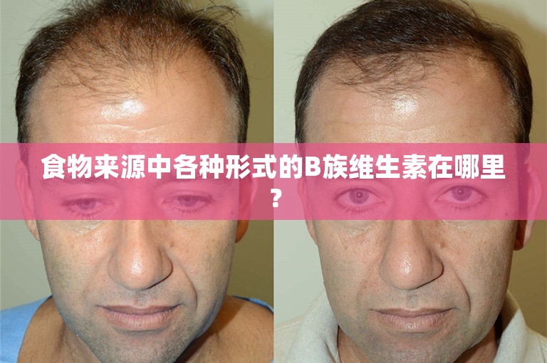 食物来源中各种形式的B族维生素在哪里? 食物来源中各种形式的B族维生素在哪里?