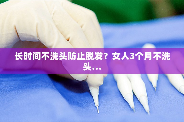 长时间不洗头防止脱发?女人3个月不洗头... 长时间不洗头防止脱发?女人3个月不洗头...