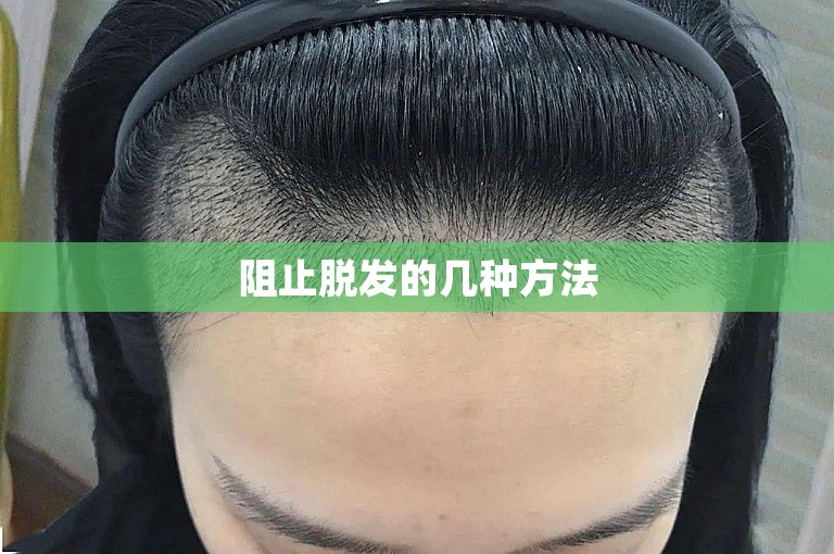 阻止脱发的几种方法