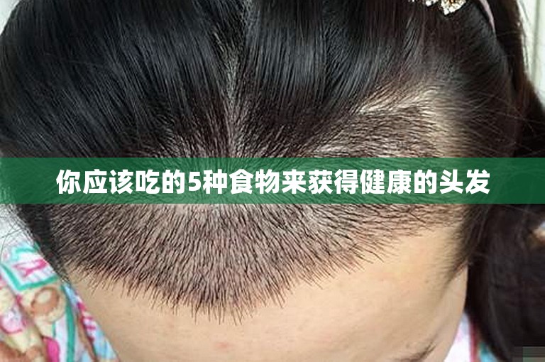 你应该吃的5种食物来获得健康的头发