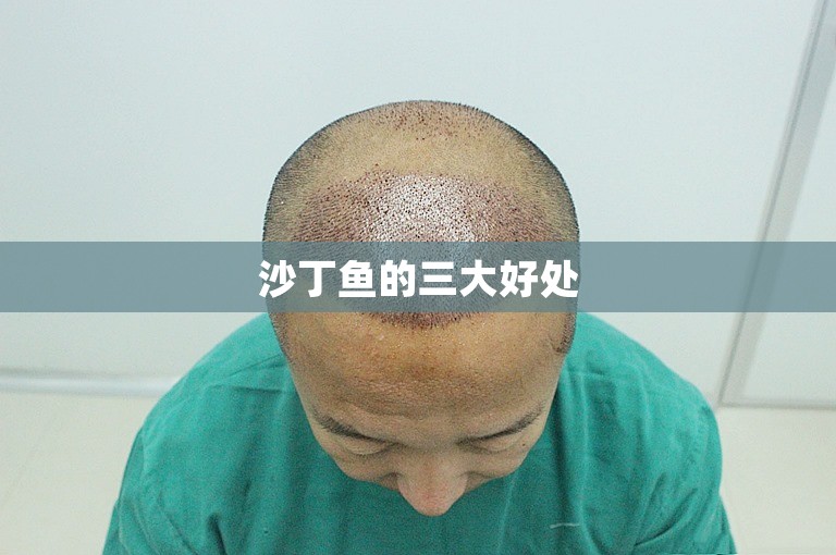 沙丁鱼的三大好处 沙丁鱼的三大好处