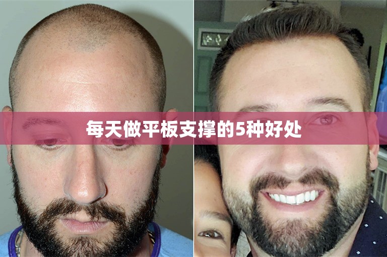 每天做平板支撑的5种好处