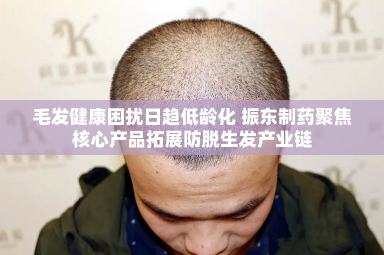 毛发健康困扰日趋低龄化 振东制药聚焦核心产品拓展防脱生发产业链