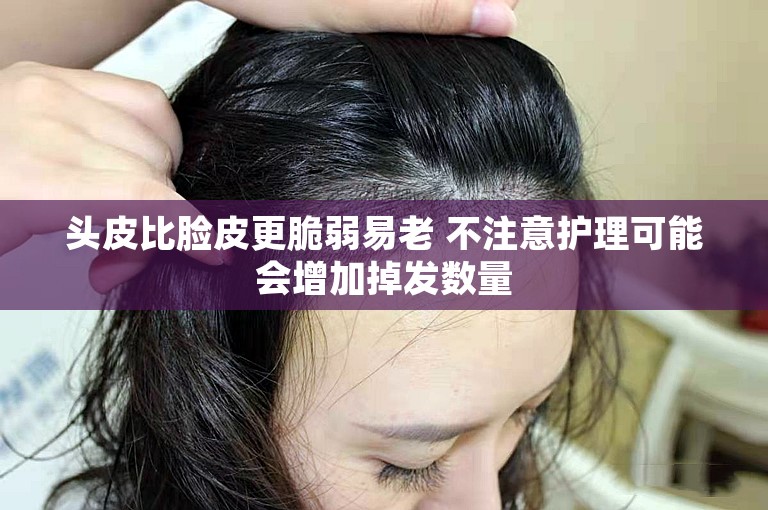 头皮比脸皮更脆弱易老 不注意护理可能会增加掉发数量