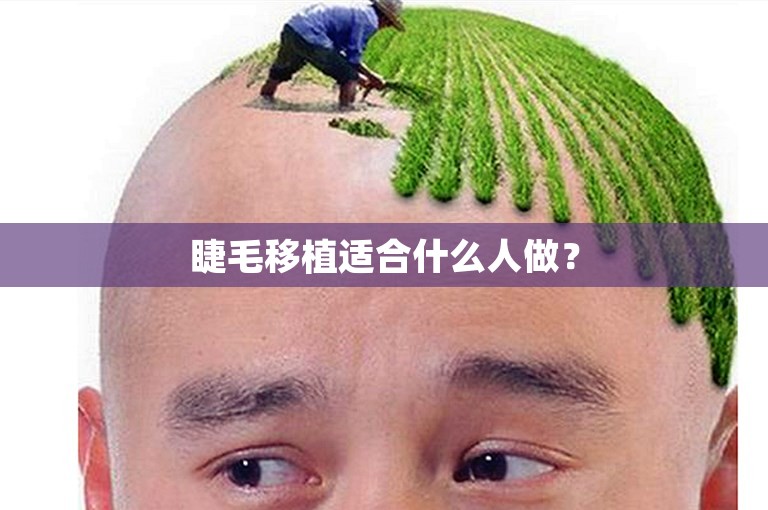 睫毛移植适合什么人做？