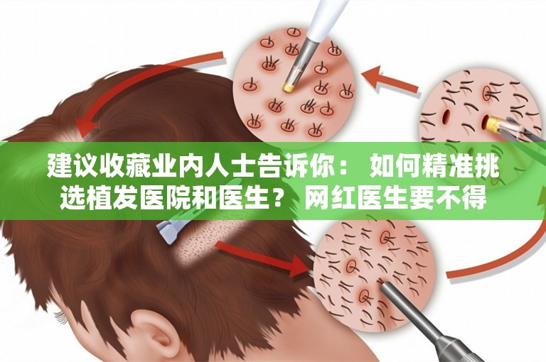 建议收藏业内人士告诉你： 如何精准挑选植发医院和医生？ 网红医生要不得