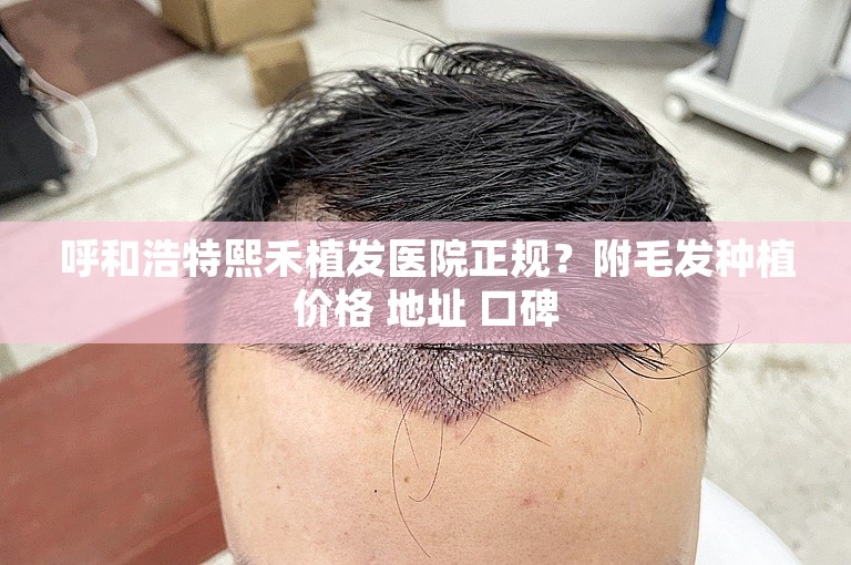 呼和浩特熙禾植发医院正规？附毛发种植价格 地址 口碑