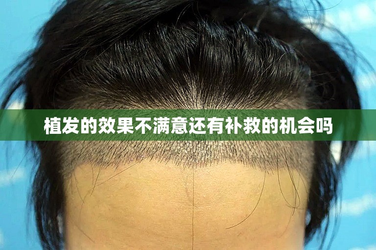 植发的效果不满意还有补救的机会吗