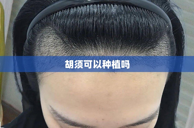 胡须可以种植吗