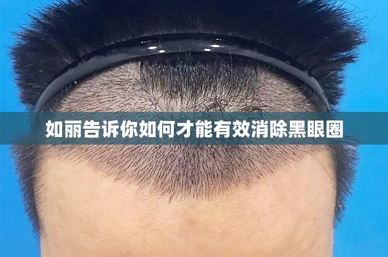 如丽告诉你如何才能有效消除黑眼圈