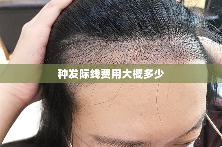 种发际线费用大概多少