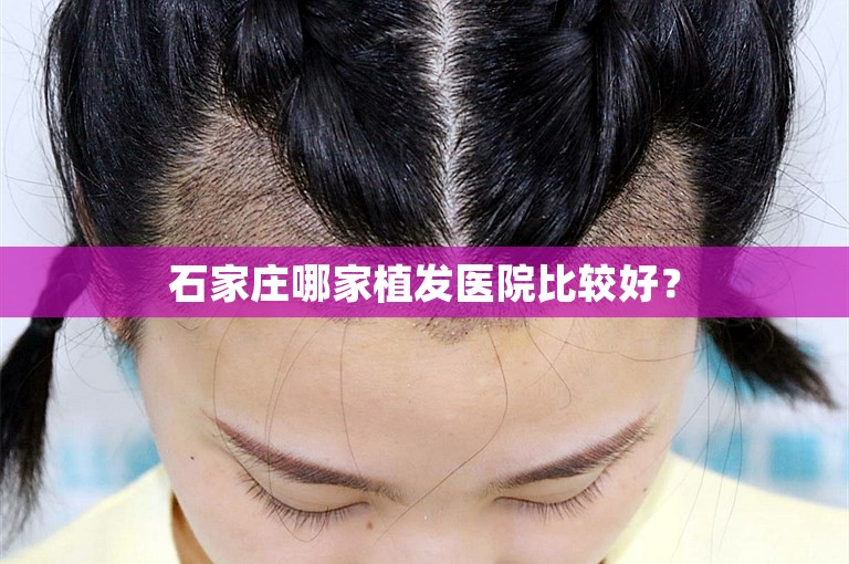 石家庄哪家植发医院比较好？