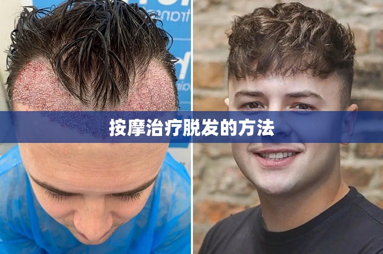 按摩治疗脱发的方法