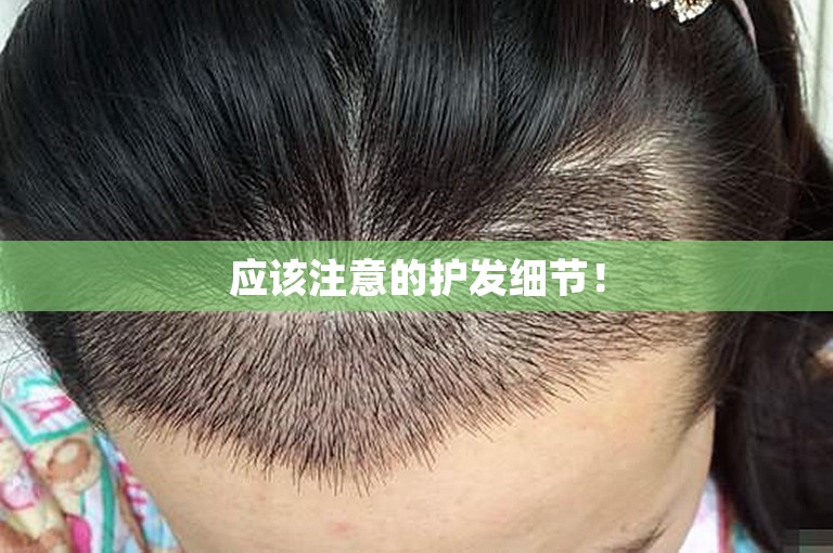 应该注意的护发细节！