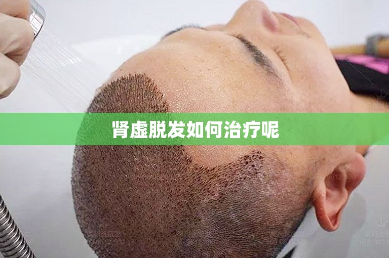 肾虚脱发如何治疗呢 肾虚脱发如何治疗呢