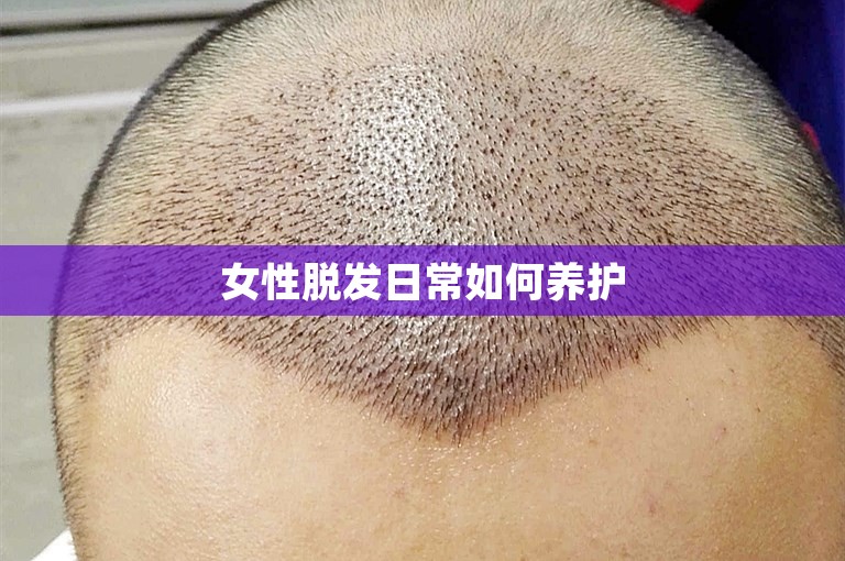 女性脱发日常如何养护