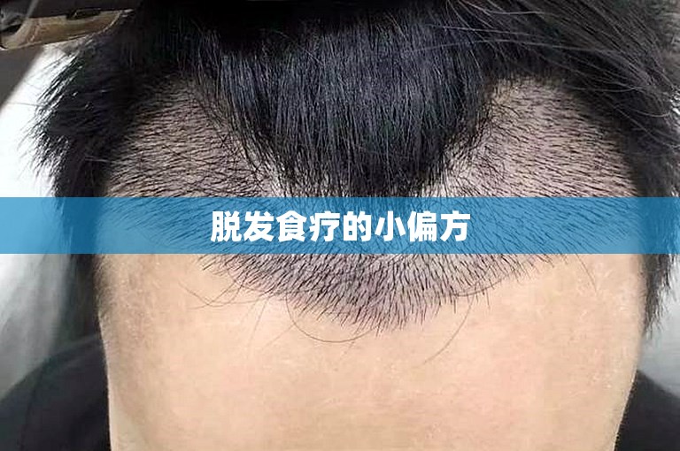 脱发食疗的小偏方