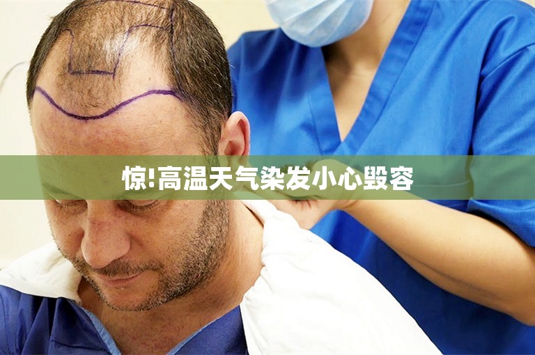 惊!高温天气染发小心毁容