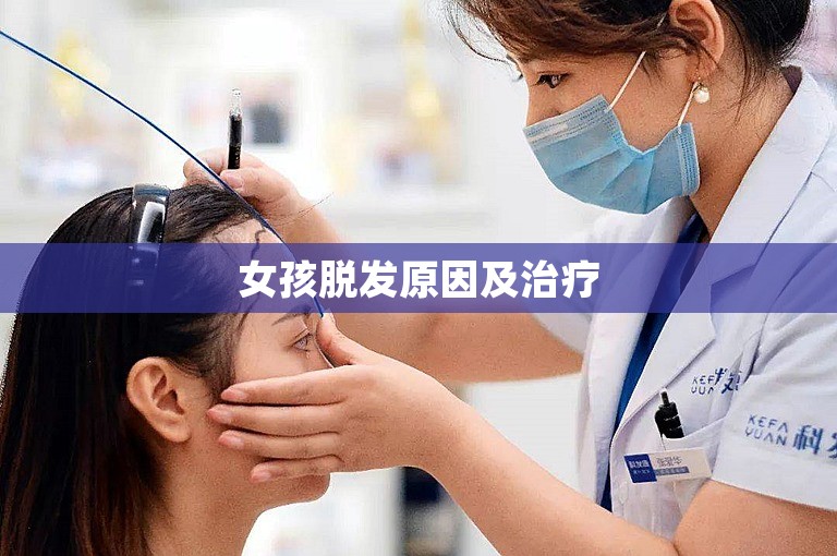女孩脱发原因及治疗