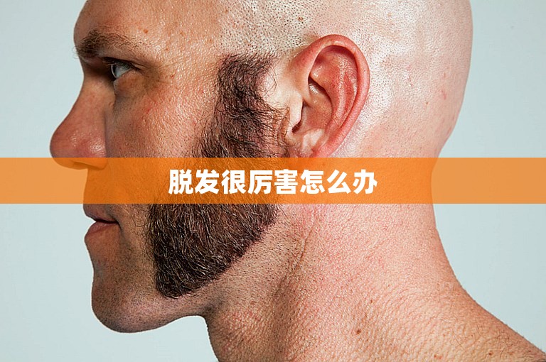 脱发很厉害怎么办