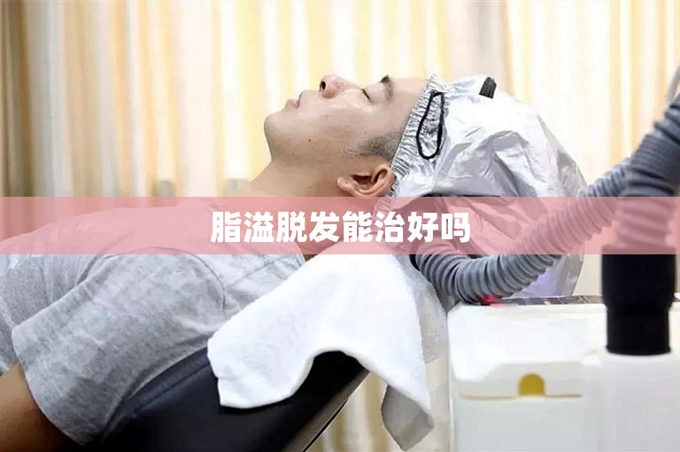 脂溢脱发能治好吗