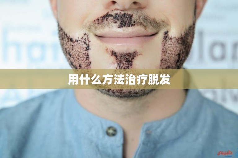 用什么方法治疗脱发