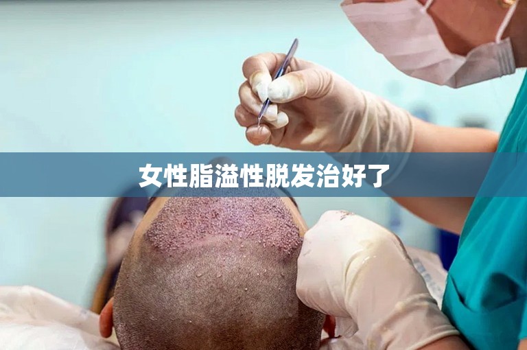 女性脂溢性脱发治好了