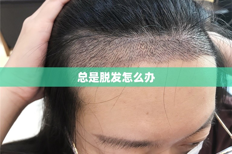 总是脱发怎么办