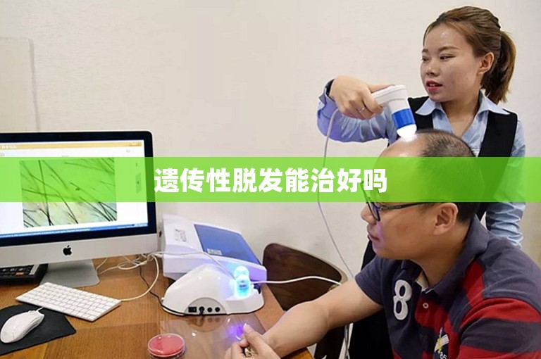 遗传性脱发能治好吗