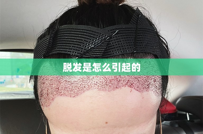 脱发是怎么引起的