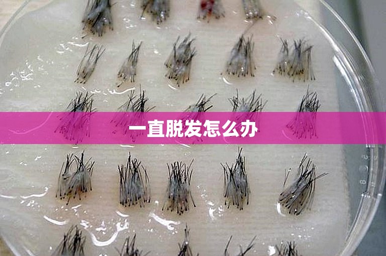 一直脱发怎么办