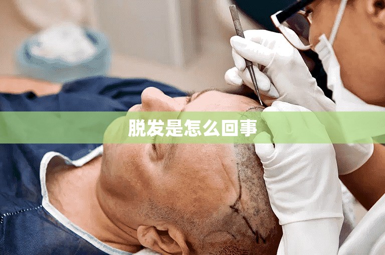脱发是怎么回事