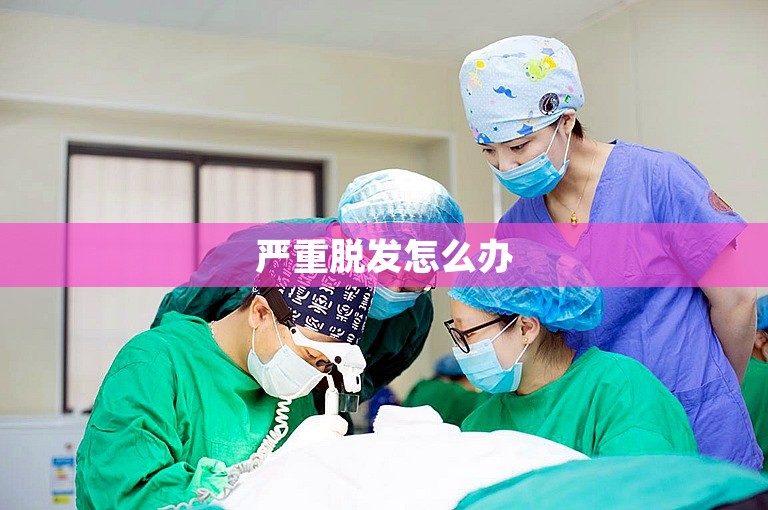 严重脱发怎么办