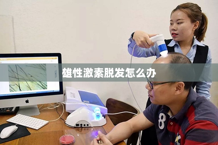 雄性激素脱发怎么办
