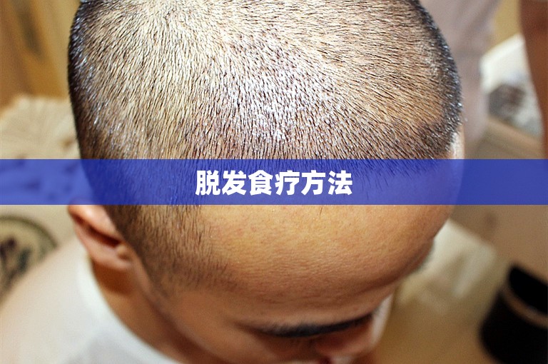 脱发食疗方法